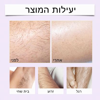 Yuri – ערכה להסרת שיער בלי סכין ובלי גירויים
